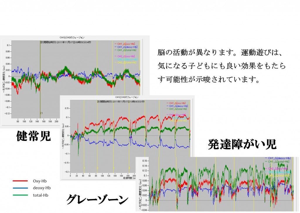 前頭前野の脳活動　グレーゾーンとADHDと健常児